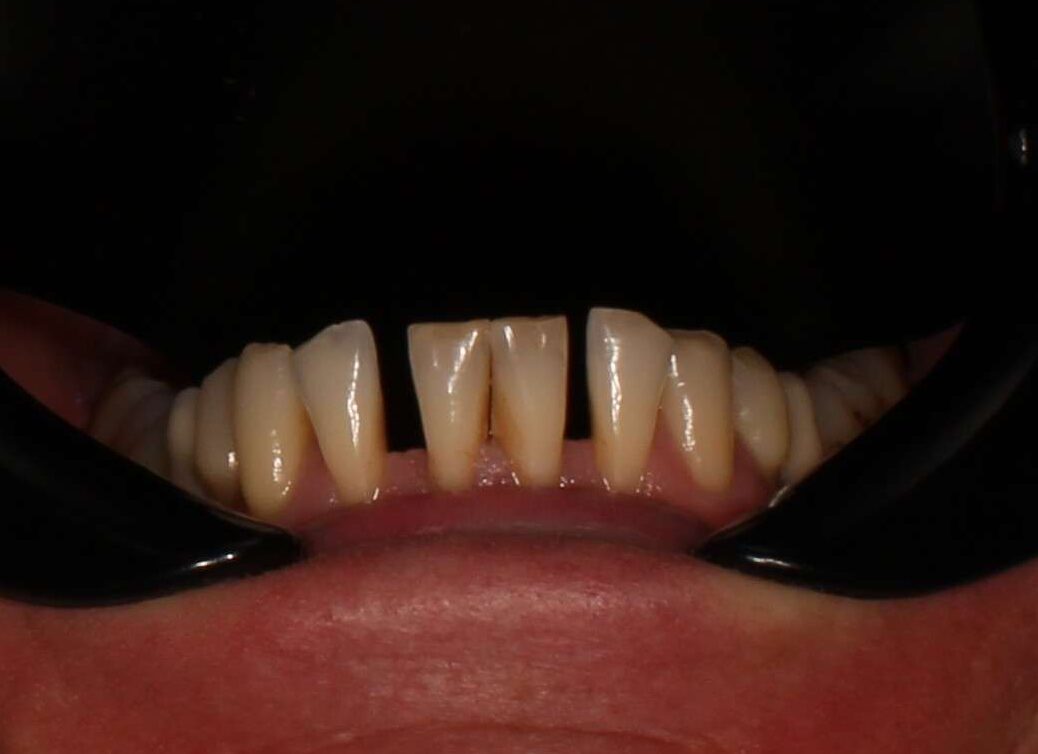 lower comps pre. contrast (1)