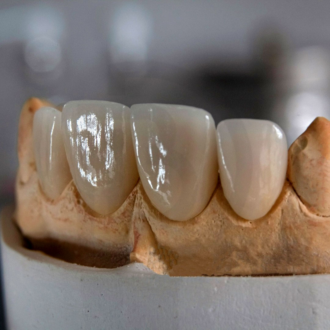 Calm-Clinic-Sedation-(IV-or-Oral)